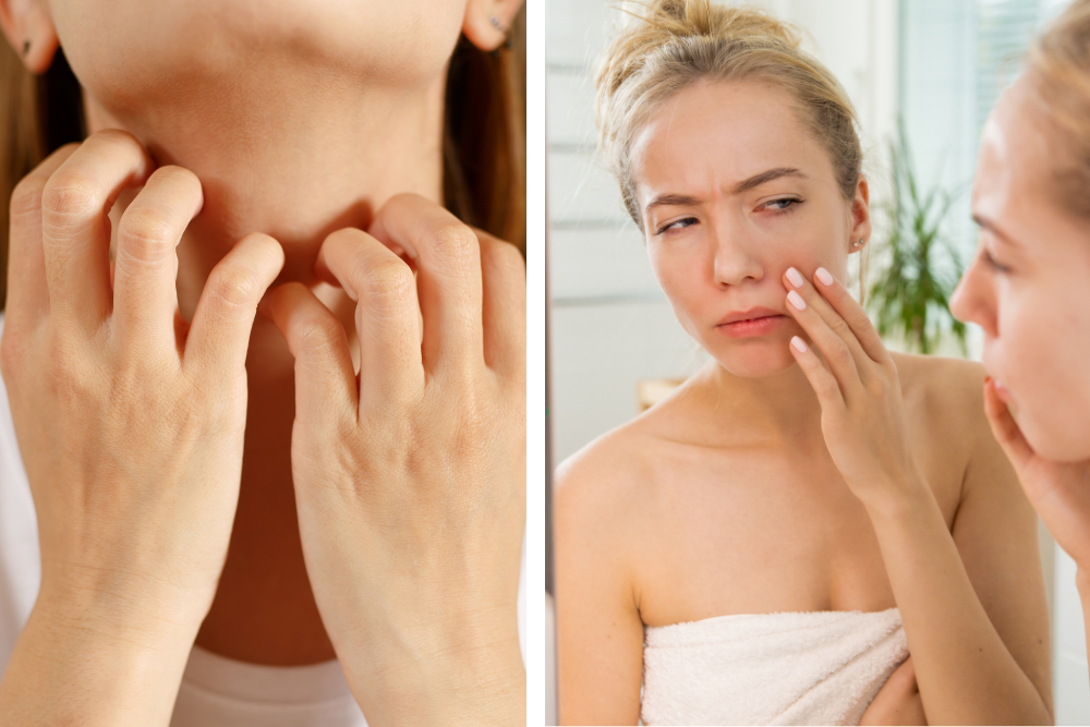 Mujer con la piel del cuello y del rostro irritada: molestias de la piel y necesidad de darle calma en el cuidado